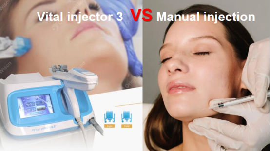 Las ventajas del inyector vital en comparación con la inyección manual